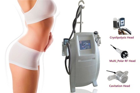 Cryolipolysis – giải pháp giảm mỡ bằng nhiệt lạnh