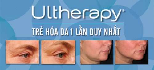 Trước và sau trị liệu với Ultherapy