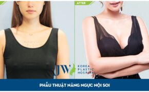 Cơ hội làm đẹp vòng 1 miễn phí với chuyên gia Hàn Quốc