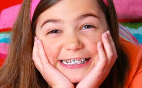 Tuổi nào niềng răng là hợp lý