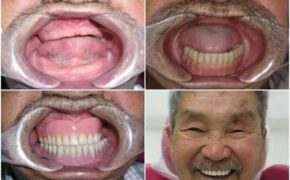 “Nụ cười hạnh phúc” mang tới 30 cơ hội làm răng miễn phí trị giá 300 triệu đồng/trường hợp