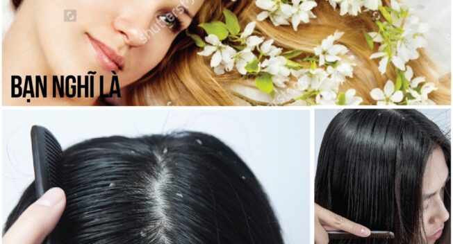 Các cô gái Hà Nội hào hứng chăm sóc bằng thảo dược mùa đông