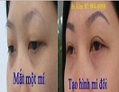 Thẩm mỹ Hàn Quốc