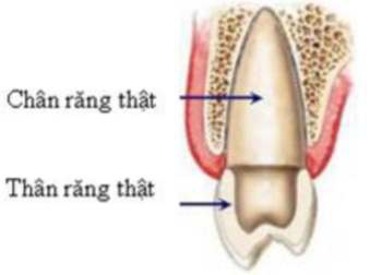 Hậu quả của mất răng và cách khắc phục - 2