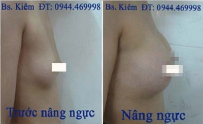 Thẩm mỹ Hàn Quốc - 3