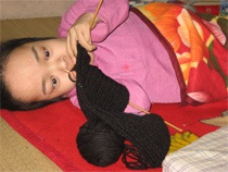 Cô gái “thủy tinh” chiến thắng bệnh tật