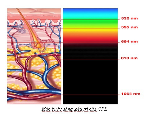 Triệt lông vĩnh viễn với công nghệ mới Laser