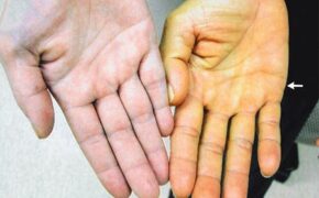 Lá gan “mát” cho làn da đẹp