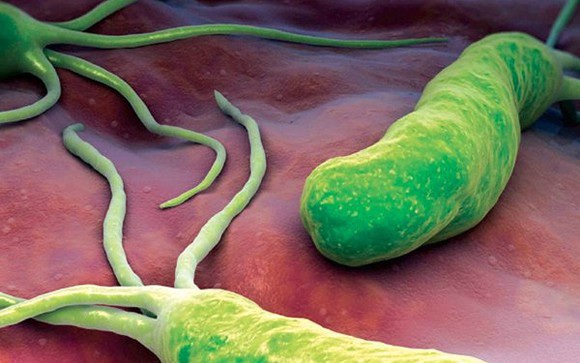 Vi khuẩn Helicobacter pylori (HP), một trong những tác nhân dễ gây tổn thương viêm, loét dạ dày tá tràng, thậm chí dẫn tới ung thư dạ dày